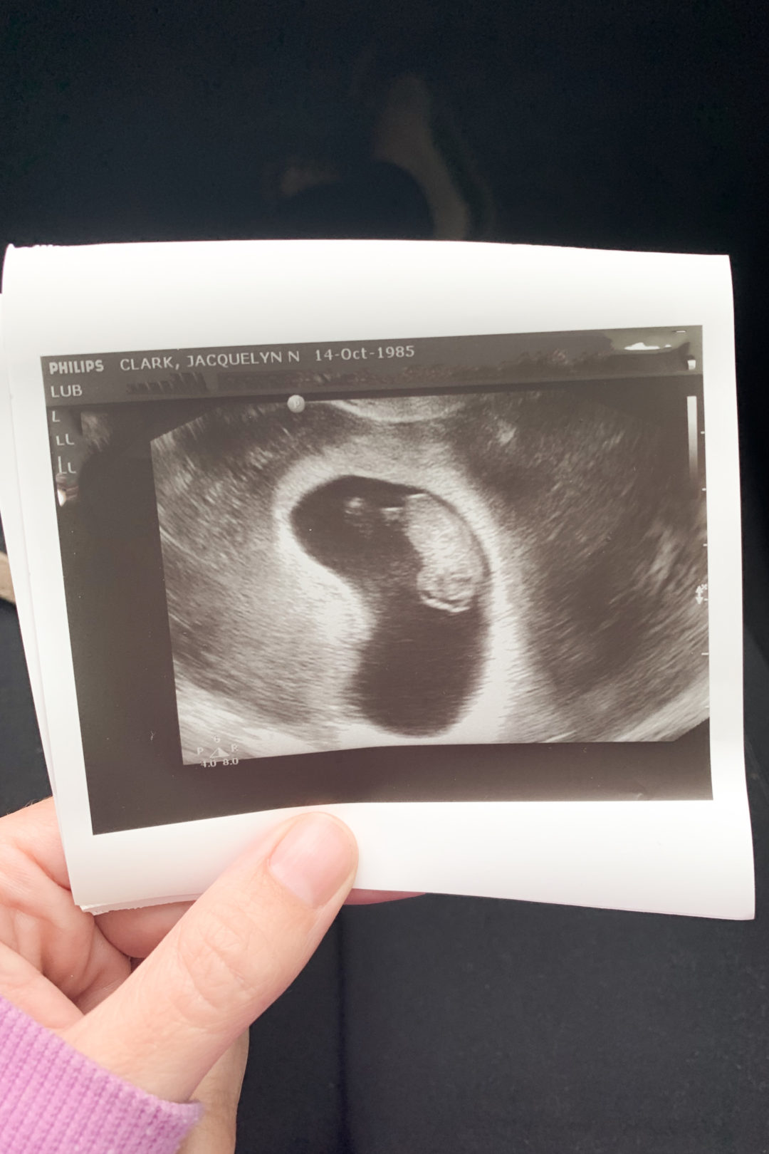 9 week ultrasound_ | Lark & Linen Interior Design and Lifestyle Blog